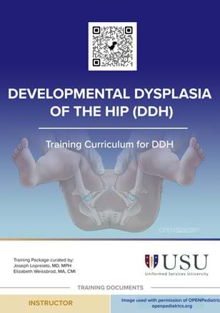 Developmental Dysplasia Of Hip Curriculum V3