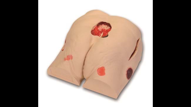Seymour II Wound Care Model aids in the identification and assessment of wounds.