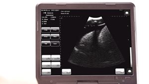 Ultrasound guided techniques practice on the chest drain model