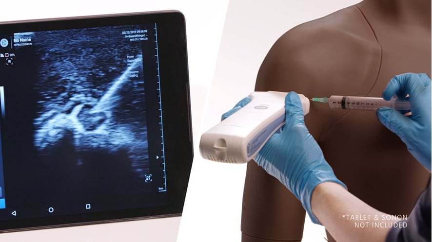 Bicep Tendon Sheath injection using the Ultrasound guided Shoulder Injection Trainer in Dark Skin Tone