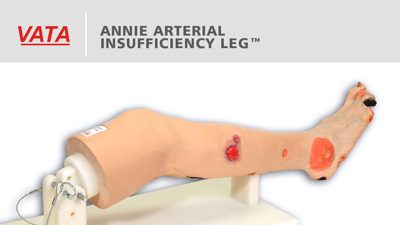 Annie Arterial Insufficiency Leg™