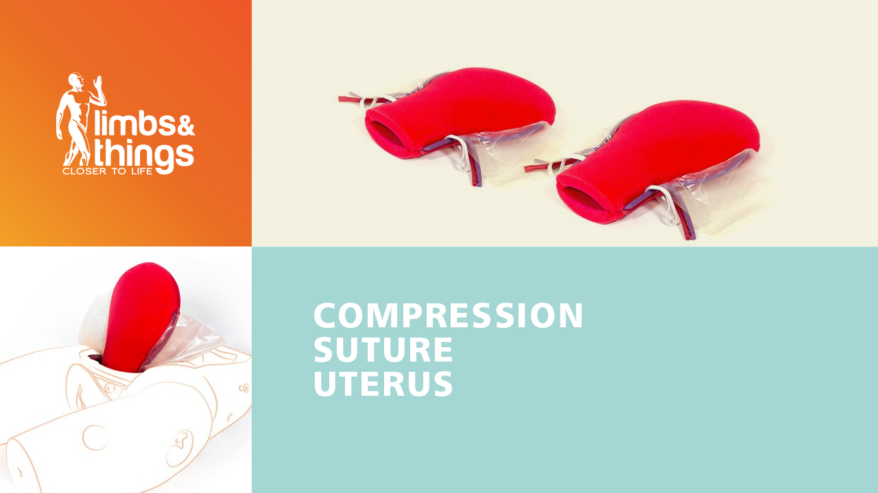 Compression Suture Uterus
