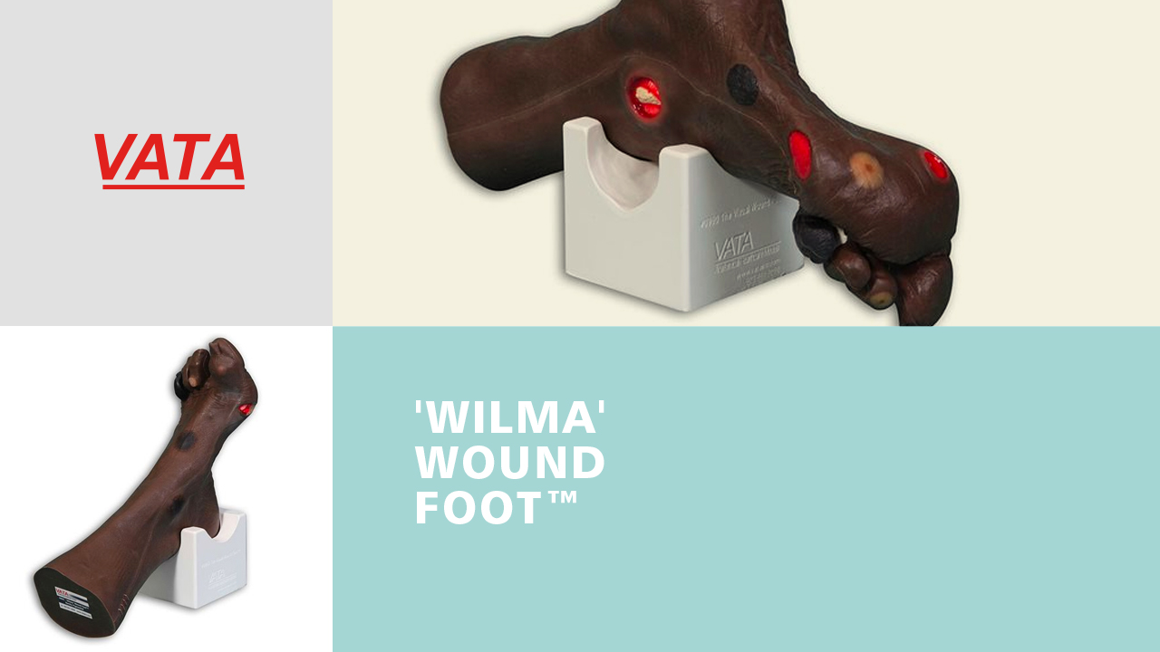 Wilma Wound Foot ™