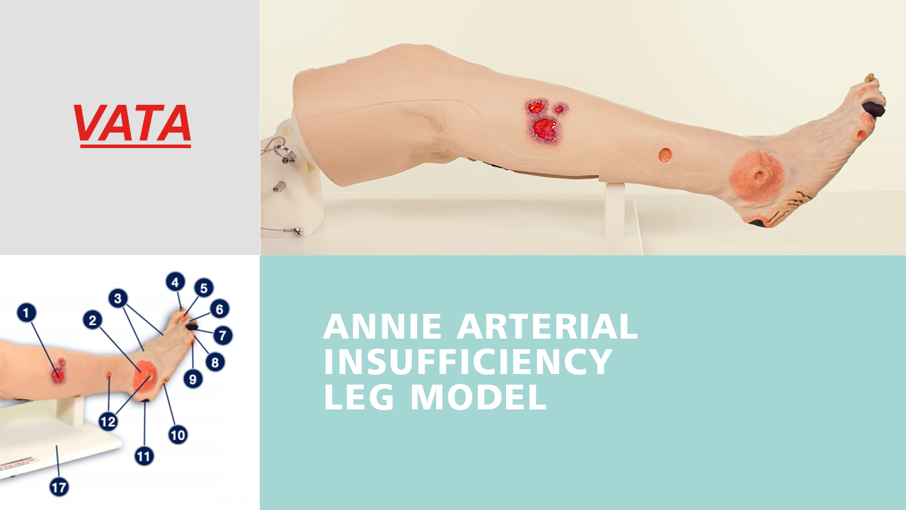 Annie Arterial Insufficiency Leg™