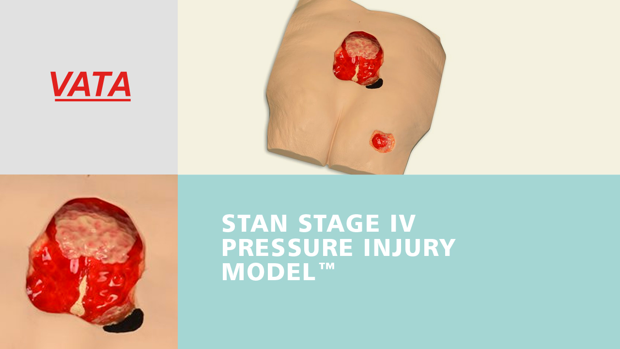 Stan Stage 4 Pressure Injury Model ™ - Light