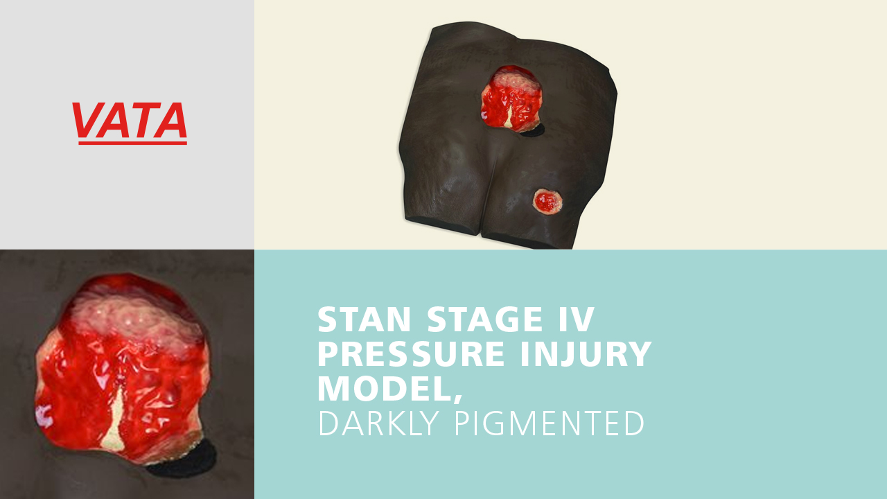 Stan Stage 4 Pressure Injury Model ™ - Dark