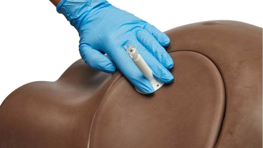 Paracentesis Trainer with ultrasound technology to support the practice of fluid removal from the abdominal region 