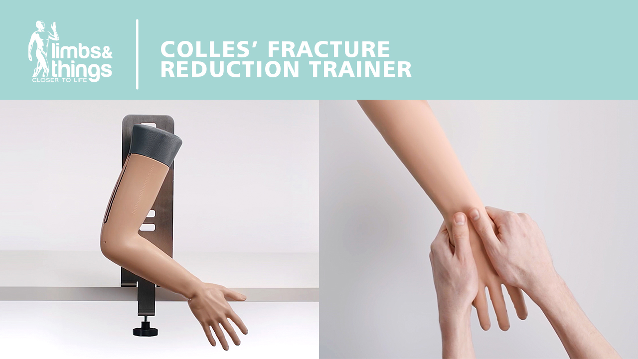 Colles' Fracture - UK