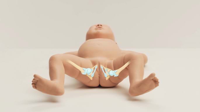 The Importance of Proper Training for the Infant Hip Exam
