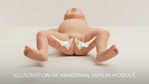 hip dysplasia demonstration of the Infant Hip Examination Trainer in light skin tone 