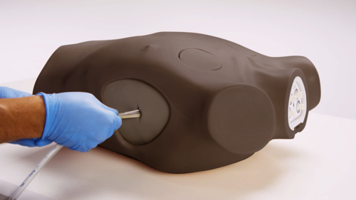 chest drain procedure