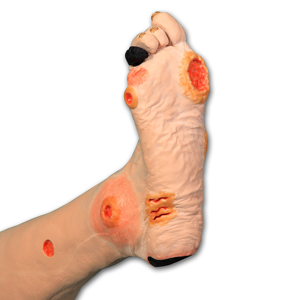 Annie Arterial Insufficiency Leg Model | Limbs & Things Global