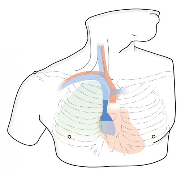 CVC Insertion Simulator II | Vascular | Kyoto Kagaku | Limbs