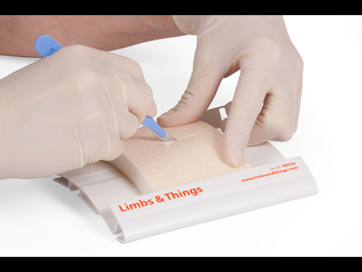 String Wounds Small Wound Closure Pads - Small (Pack of 12, LST)
