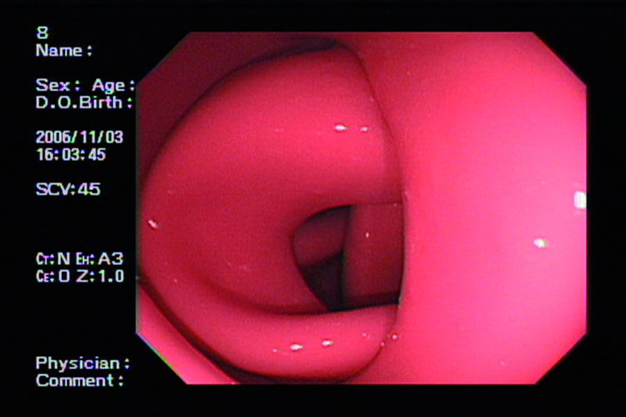 Colonoscopy Training Simulator (Light Skin Tone) | Limbs & Things UK