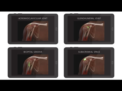 Shoulder Injection Trainer - Palpation Guided (without tablet) | Limbs ...