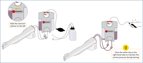Fully prime the venipuncture arm veins to prepare for use