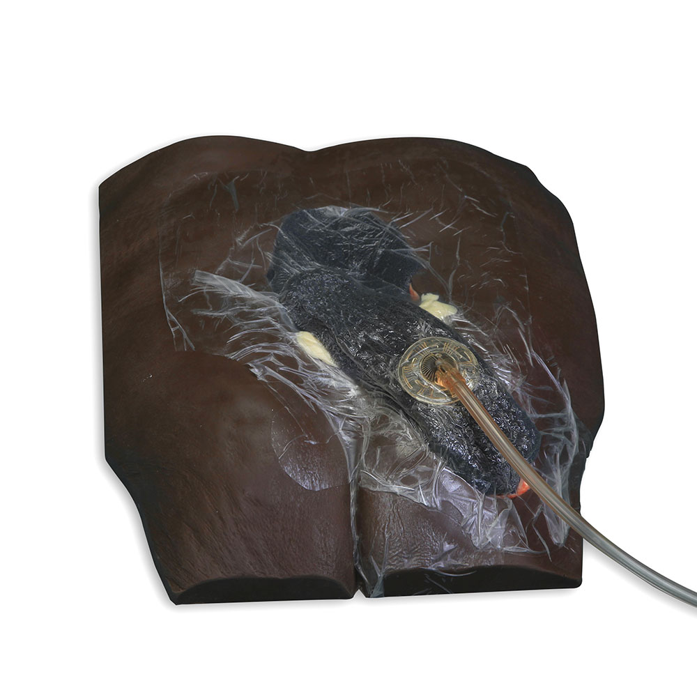 VATA's Dark Skin Stage IV Pressure Injury Model | Limbs