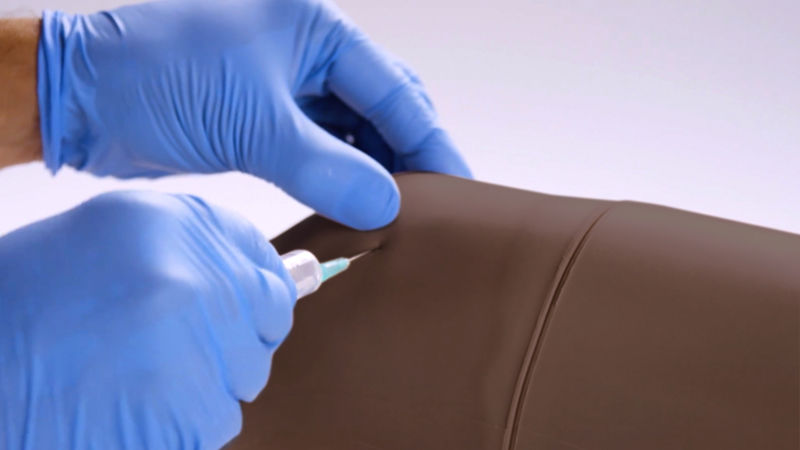 Aspiration Injection Knee Aspiration & Injection Trainer with Ultrasound Capabilities ...