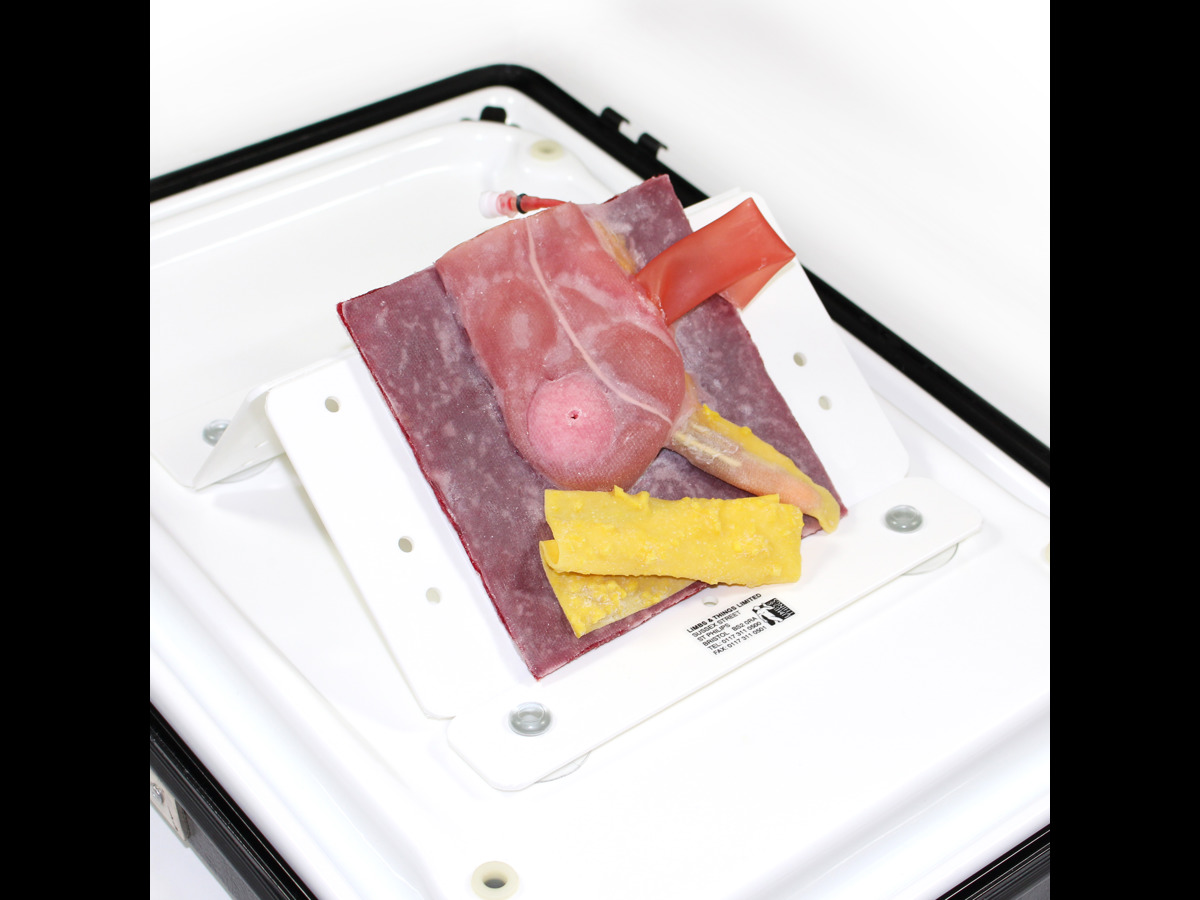 Appendix Model Kit Vermiform Appendix - Normal Anatomy | Limbs & Things Global