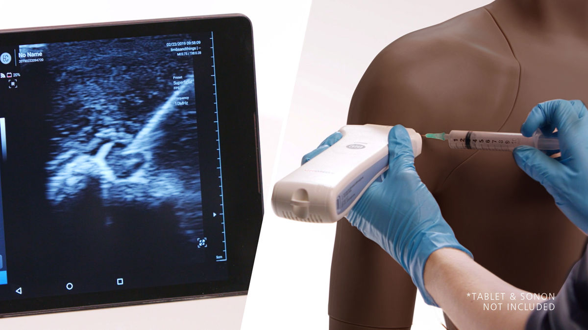 Shoulder Injection Trainer - Ultrasound Guided (Dark Skin Tone) | Limbs ...
