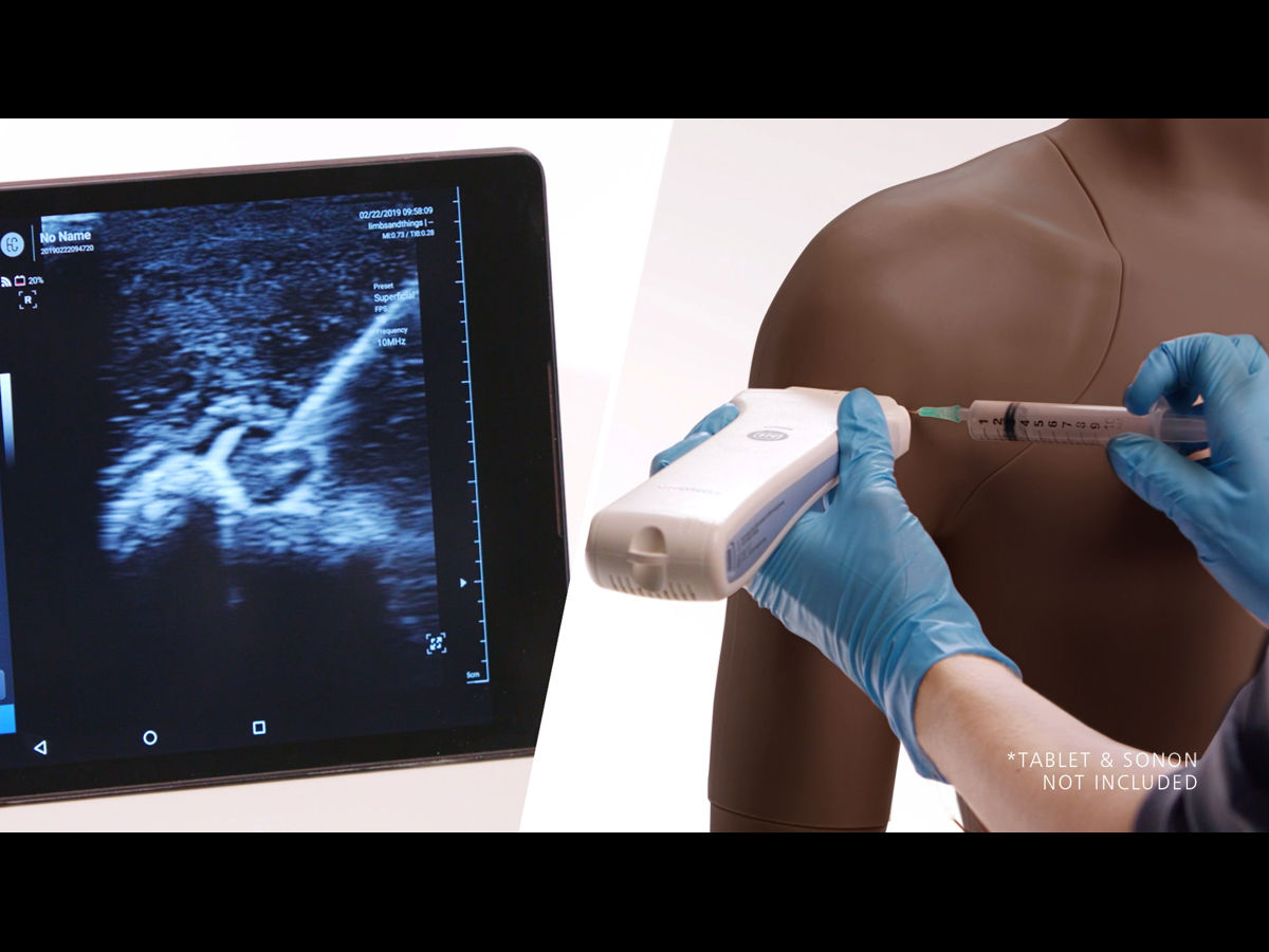 Ap Shoulder Injection Shoulder Injection Trainer - Ultrasound Guided (Dark Skin Tone) | Limbs ...