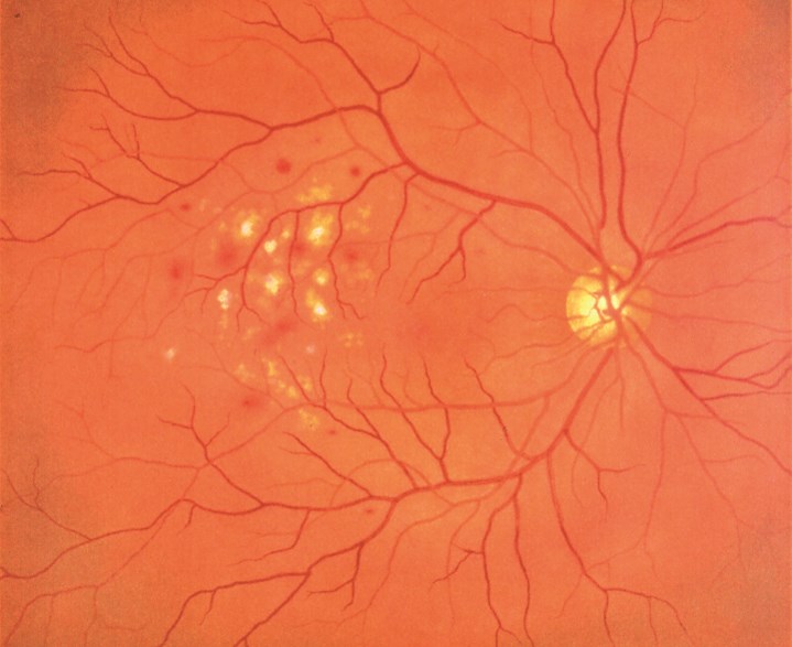 【裁断済】Pocket knowledge for eye disease 2n KKM82A Eye Examination Simulator | Limbs & Things US