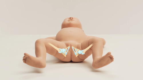 infant hip examination