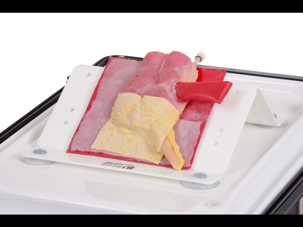 Vermiform Appendix - Normal Anatomy | Limbs & Things Global