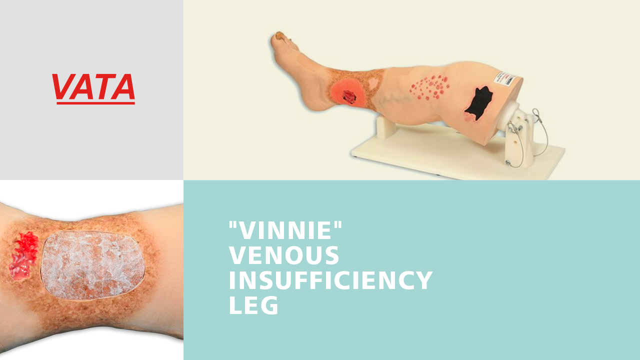 Vinnie Venous Insufficiency Leg™ UG